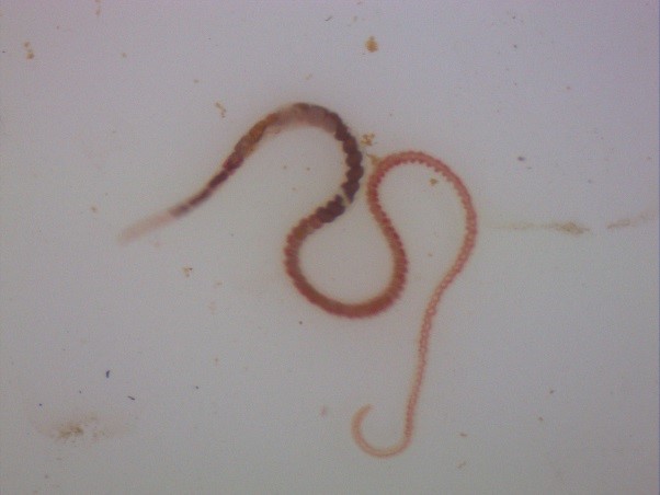 Limnodrilus hoffmeisteri