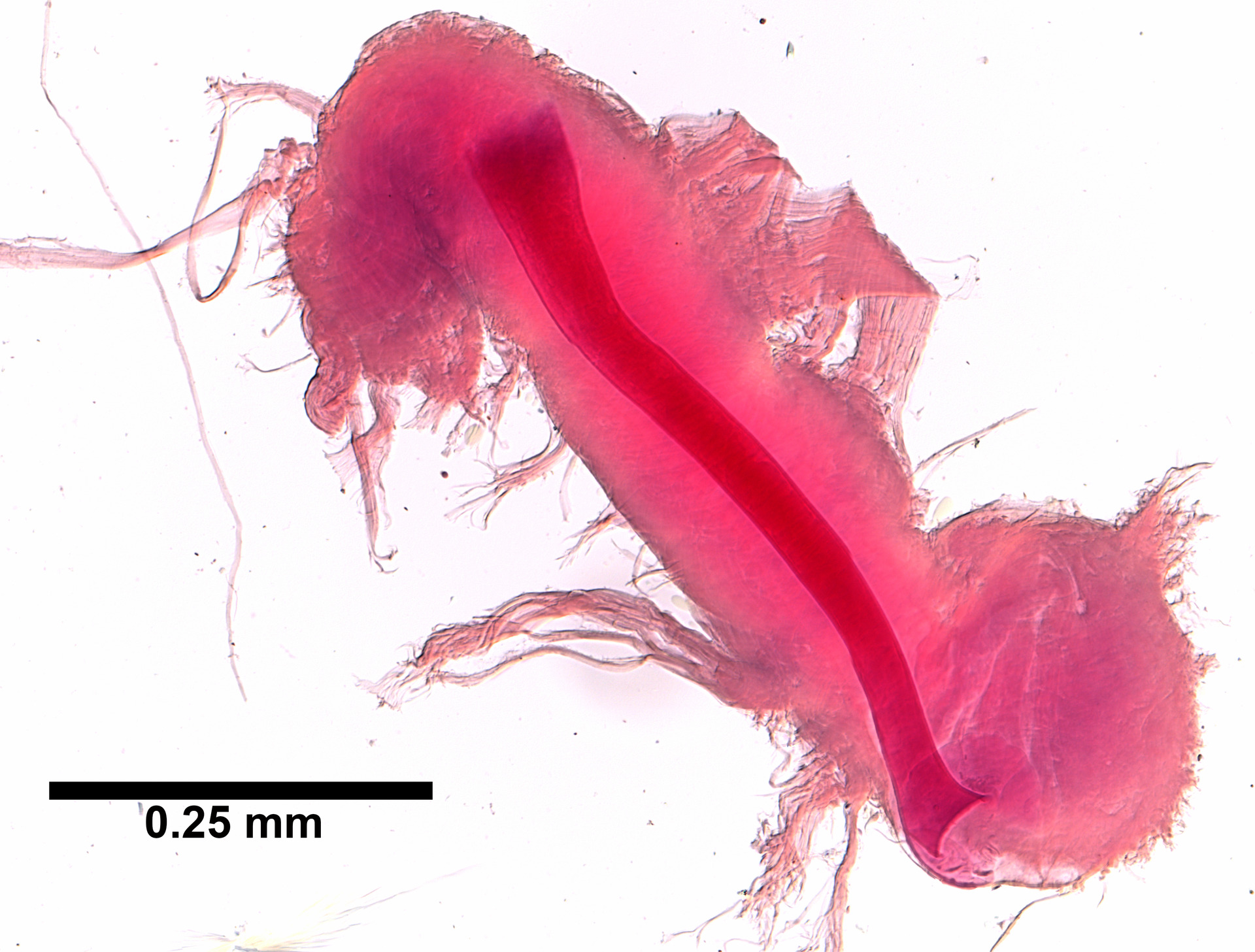 Thumbnail 3 Limnodrilus hoffmeisteri